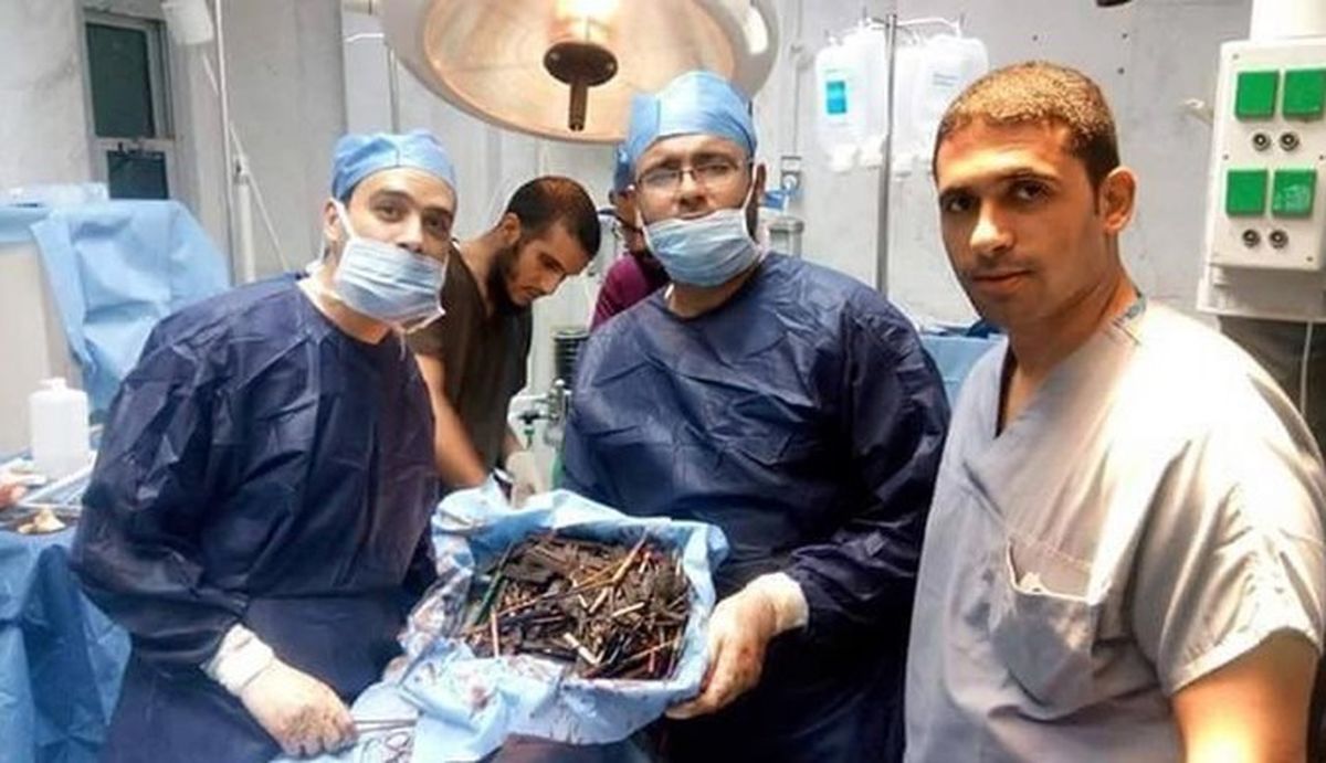 معده زن مصری که انبار لوازم اوراقی بود! +تصاویر