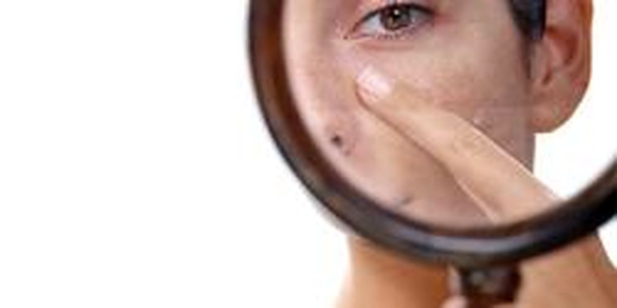 ۵ توصیه مهم برای بستن منافذ پوست
