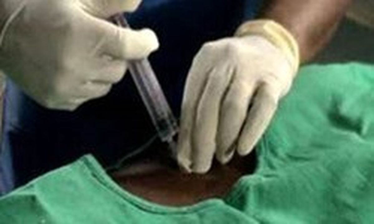 سودجویی نوین به نام «ازون‌تراپی» +تصاویر