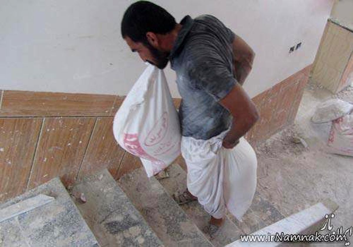 قدرت عجیب دندان‌های گچ کار ایرانی +عکس