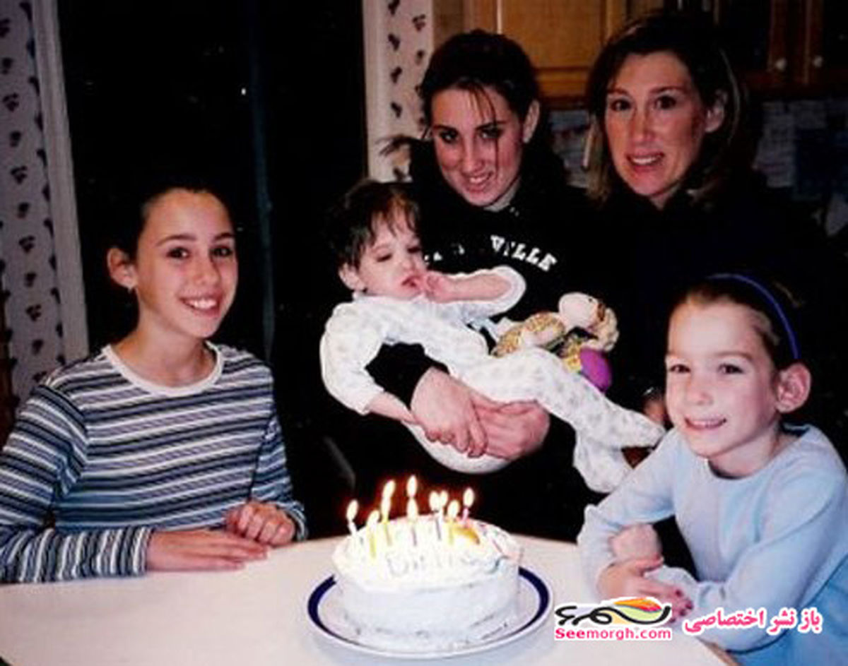 دختر 16 ساله اي كه شبيه نوزادان است+عكس