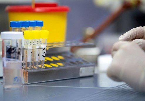 مرگهای کرونایی روزانه بالا در اروپا