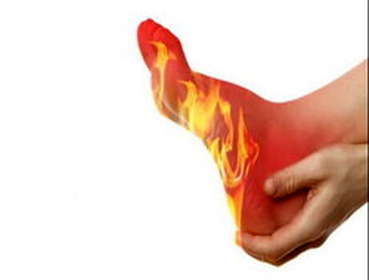 ۴ عامل موثر در بروز «گُر گرفتگی»