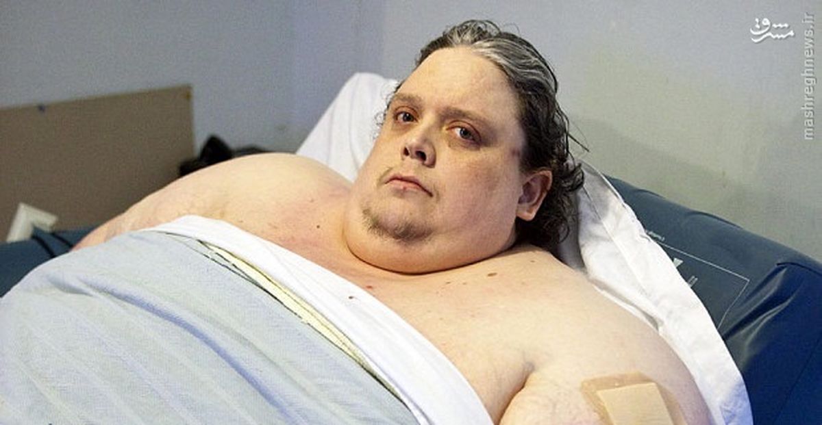 عکس/ مرگ چاق‌ترین انسان جهان
