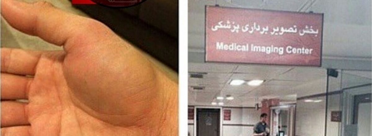 مدافع پرسپولیس در بیمارستان/عکس
