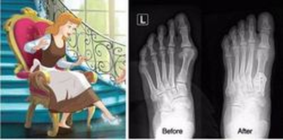 جنون سیندرلا شدن! +عکس