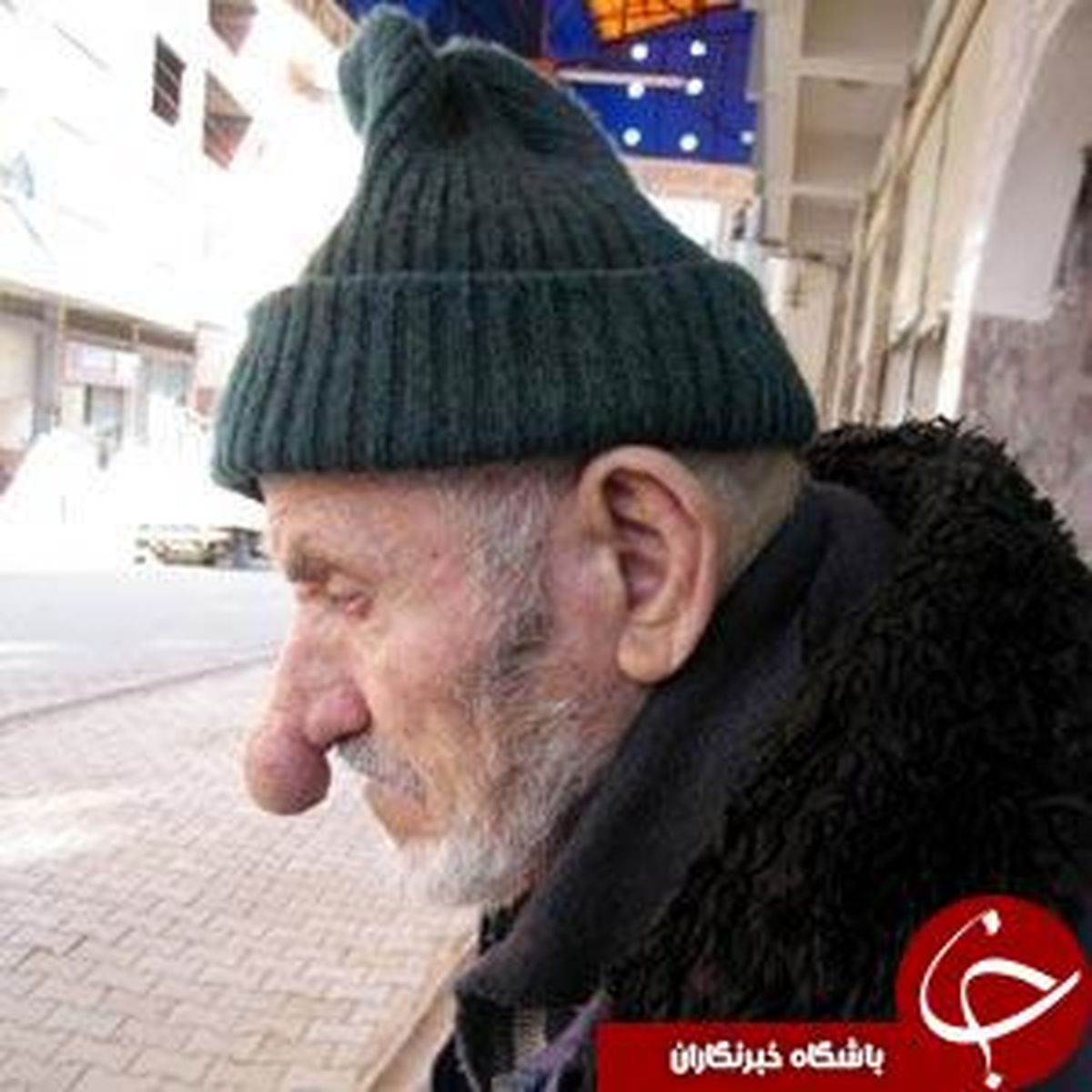 «دده پینوکیو »؛صاحب درازترین بینی جهان! +عکس