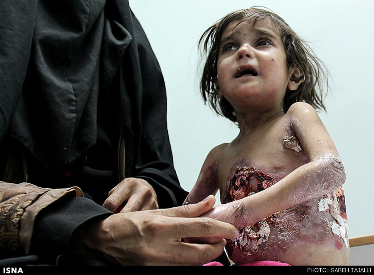 بیماری عجیب کودکان جیرفتی