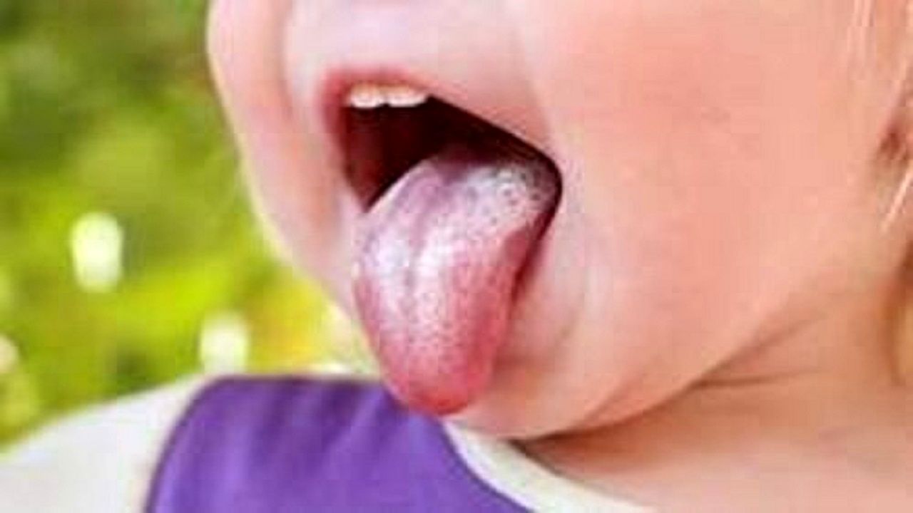 تغییر رنگ زبان انسان نشانه چیست؟