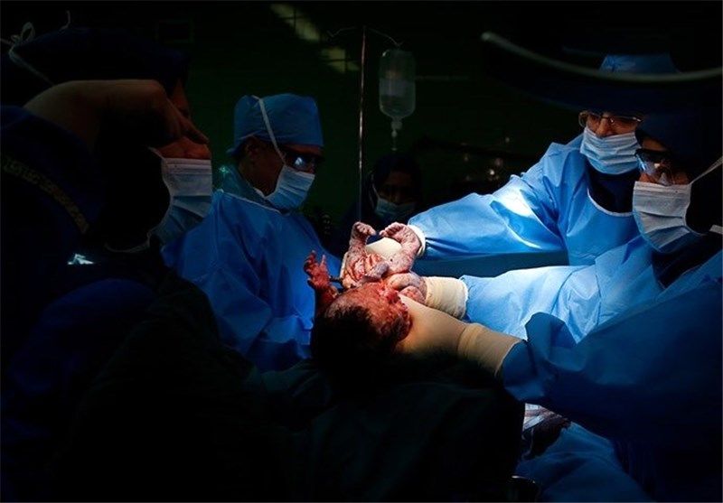 ممنوعیت سزارین‌های غیرضروری درتاریخ ۱۴۰۴/۰۴/۰۴