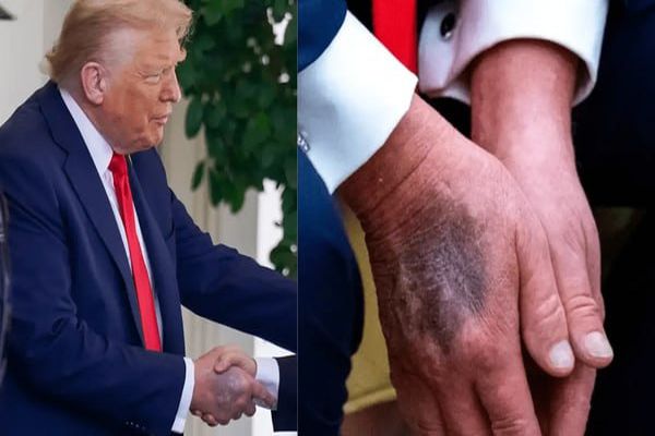 معاینه ترامپ در بیمارستان نظامی؛ کاخ سفید: کاملا سالم است