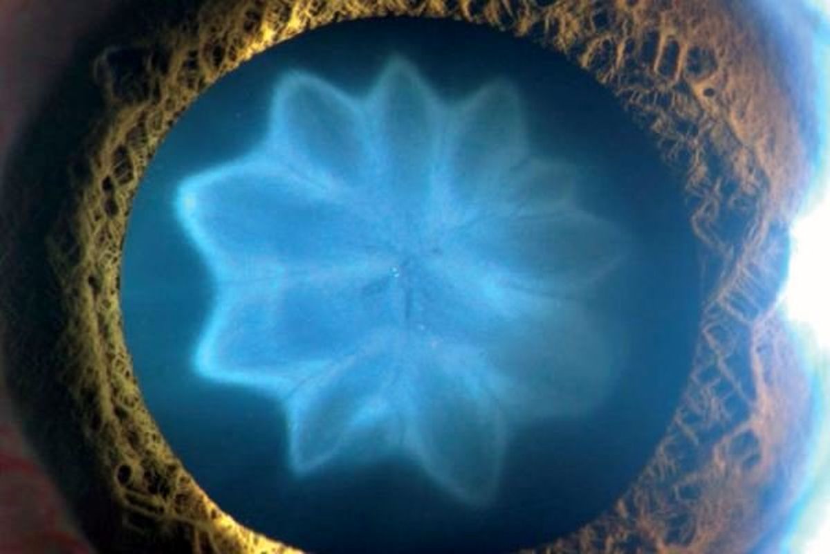 رویش گل در چشم یک مرد هندی! +عکس