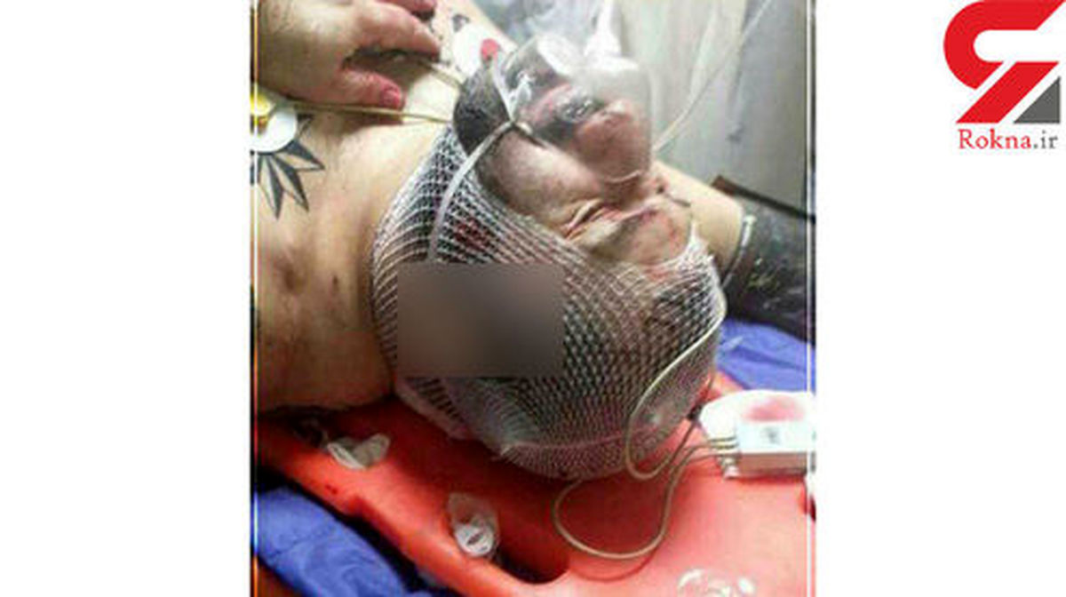 حمله دو موتور سوار به هانی کرده گنده لات تهران +عکس