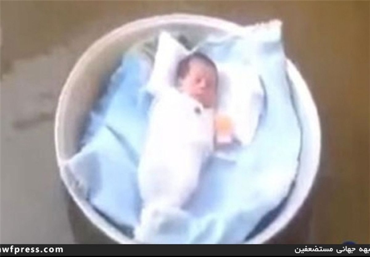 عکس:نجات معجزه‌ آسای کودک یمنی با ابتکار مادرش